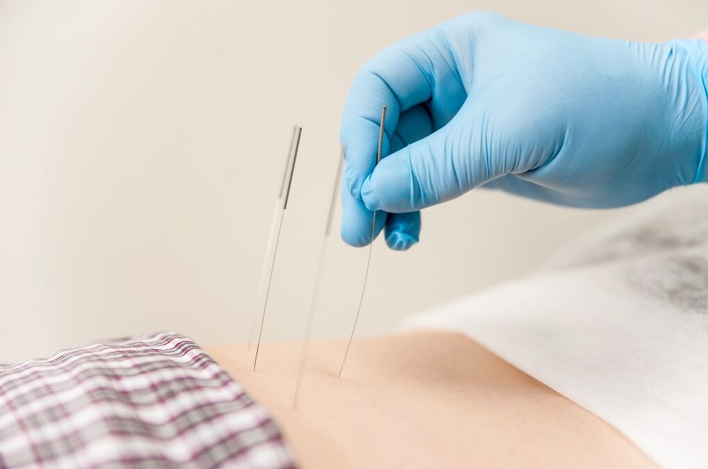 Trattamento dell'osteocondrosi toracica