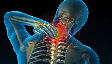 Sintomi di osteocondosi della colonna cervicale