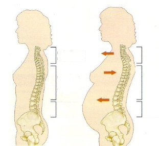 osteocondrosi durante la gravidanza