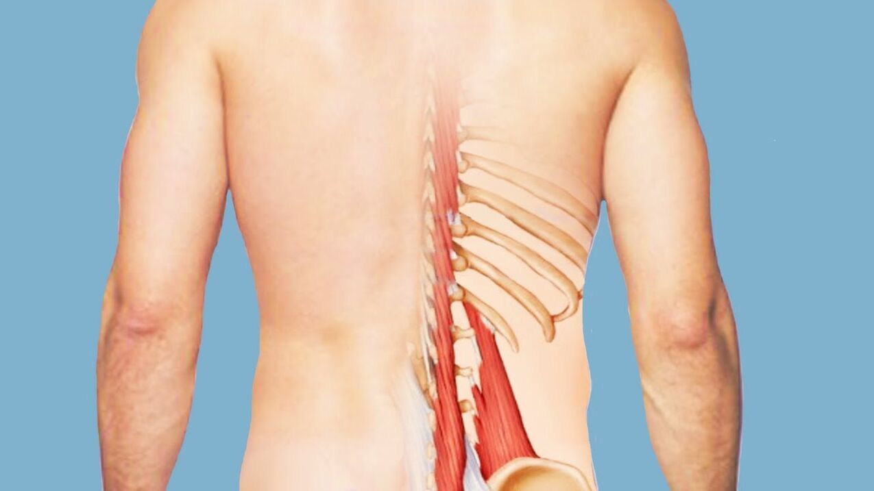 miosite come causa di mal di schiena
