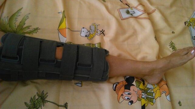 immobilizzazione dell'articolazione del ginocchio per il dolore